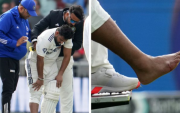 Injured Rishabh Pant (image via X)